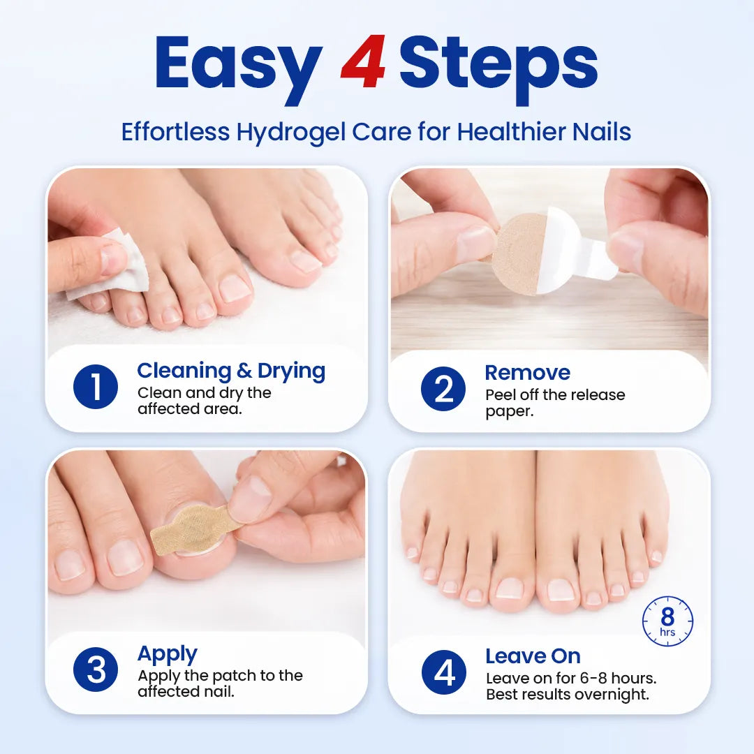 Fungal Nail Repair Patches