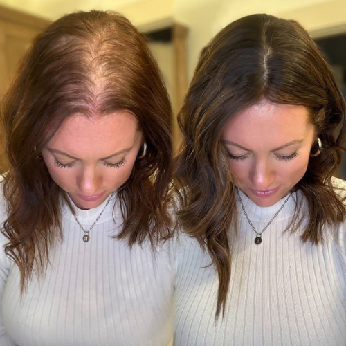 Advanced Hair Growth Roll-on Serum-Two minutes, twice a day.