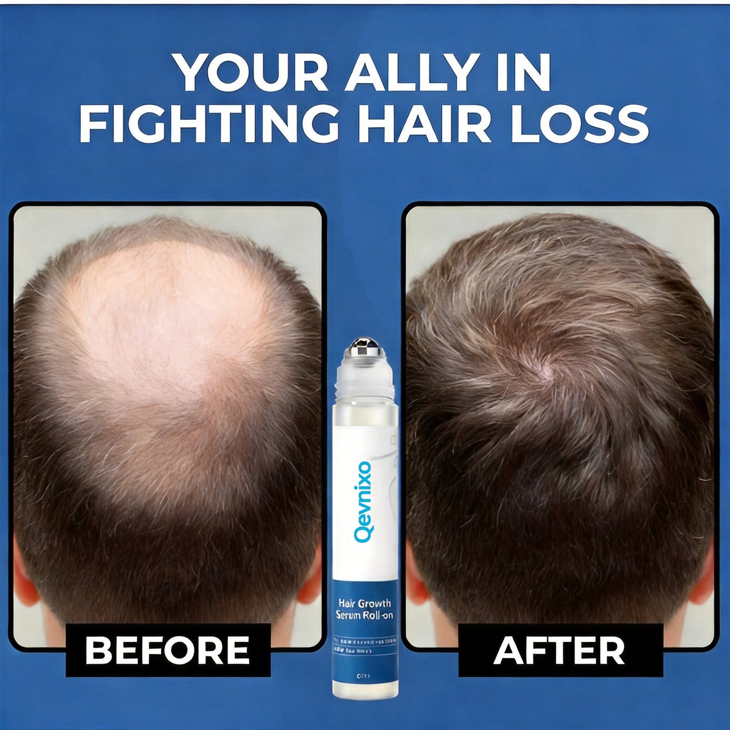 Qevnixo Hair Growth Rollon Serum