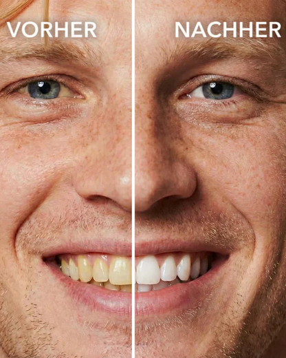 🔥2026 New Year Special Offer—Aegiri Tooth Polish - Instant Clean Smile