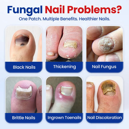 Fungal Nail Repair Patches